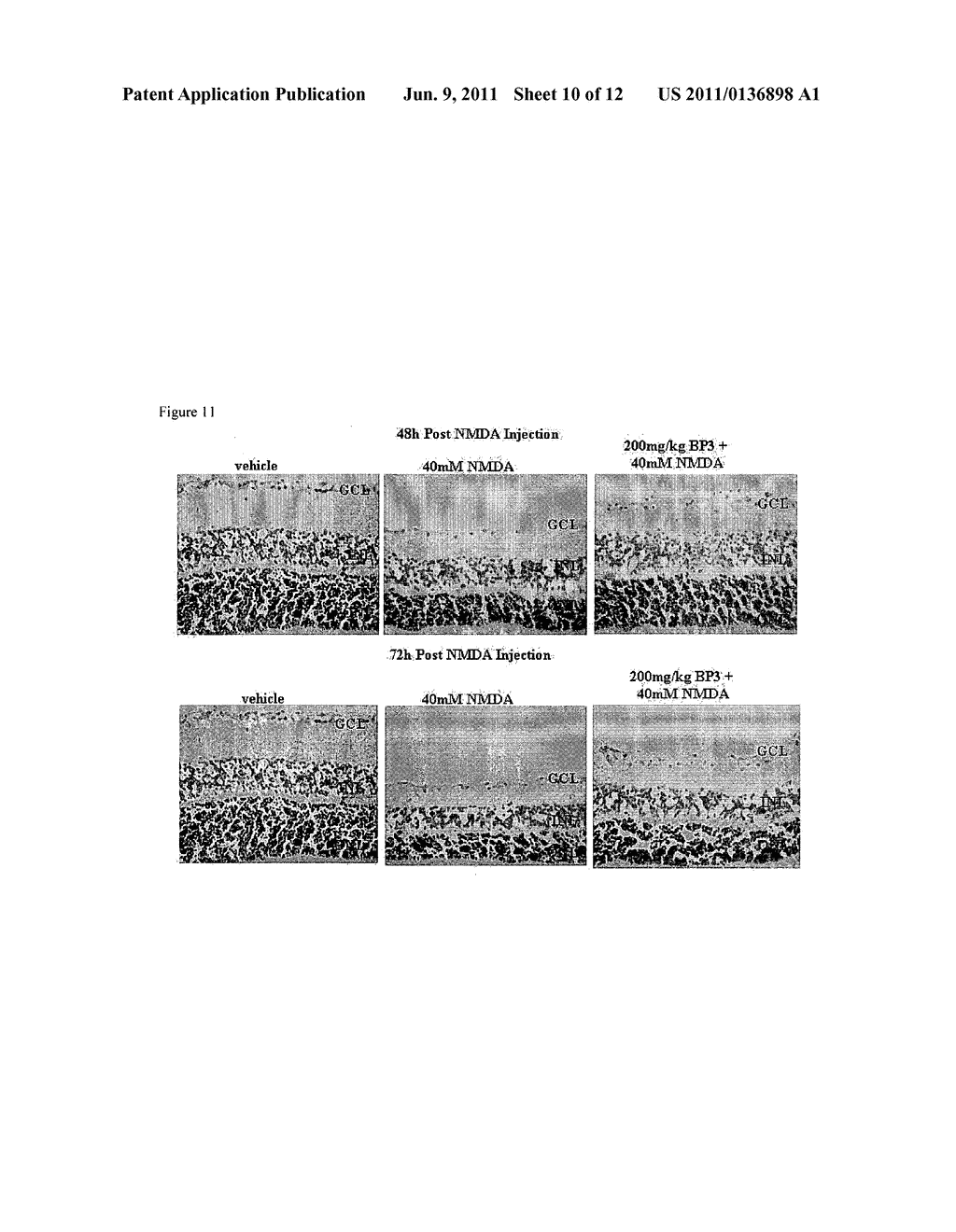 TREATMENT OF RETINAL DEGENERATION - diagram, schematic, and image 11