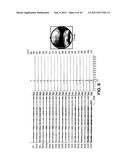 SYSTEMS AND METHODS FOR DEPRESSION TREATMENT USING NEURO-EEG     SYNCHRONIZATION THERAPY diagram and image