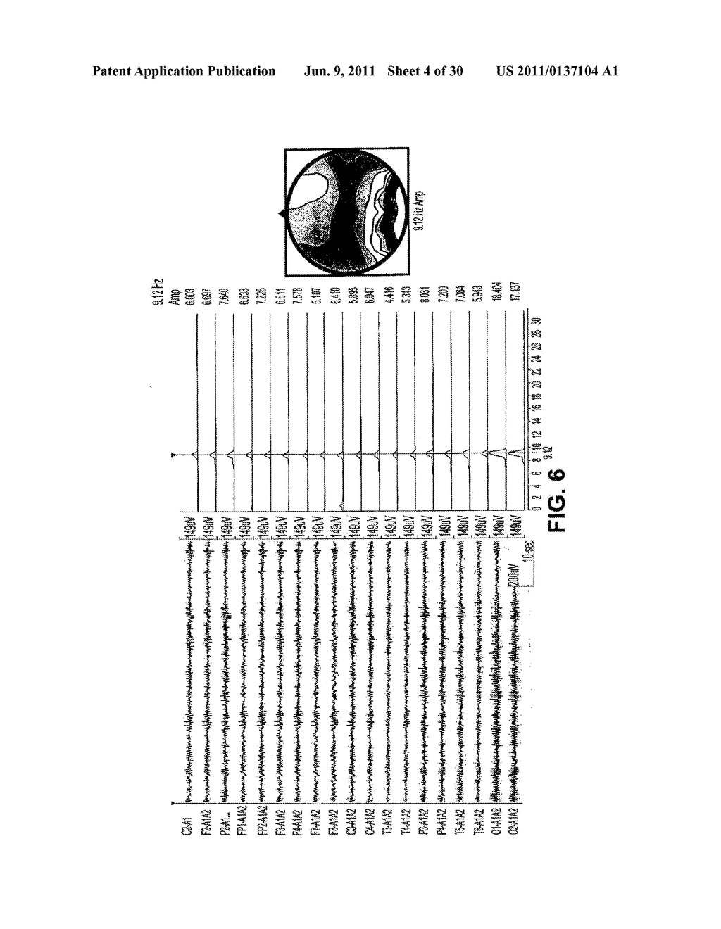 SYSTEMS AND METHODS FOR DEPRESSION TREATMENT USING NEURO-EEG     SYNCHRONIZATION THERAPY - diagram, schematic, and image 05