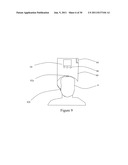 SYSTEMS AND METHODS FOR DEPRESSION TREATMENT USING NEURO-EEG     SYNCHRONIZATION THERAPY diagram and image