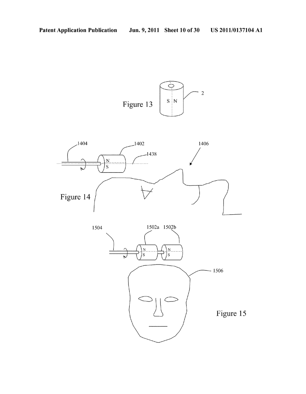 SYSTEMS AND METHODS FOR DEPRESSION TREATMENT USING NEURO-EEG     SYNCHRONIZATION THERAPY - diagram, schematic, and image 11