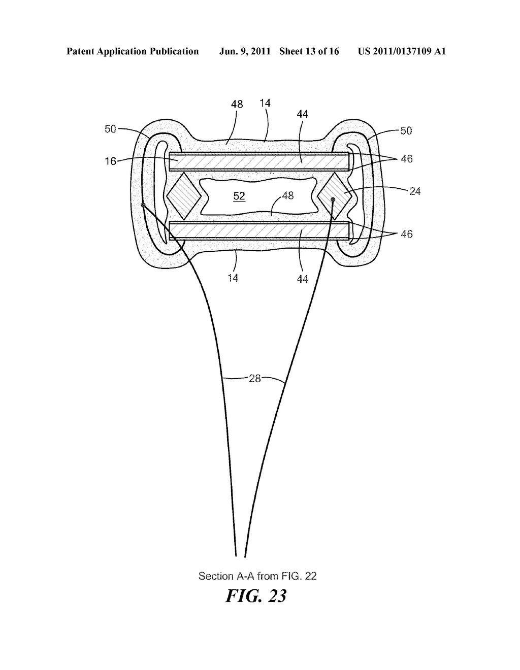 IMPLANTABLE MICROPHONE FOR HEARING SYSTEMS - diagram, schematic, and image 14