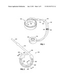 GASTRIC BAND WITH ELECTRIC STIMULATION diagram and image