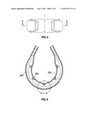 GASTRIC BAND WITH ELECTRIC STIMULATION diagram and image