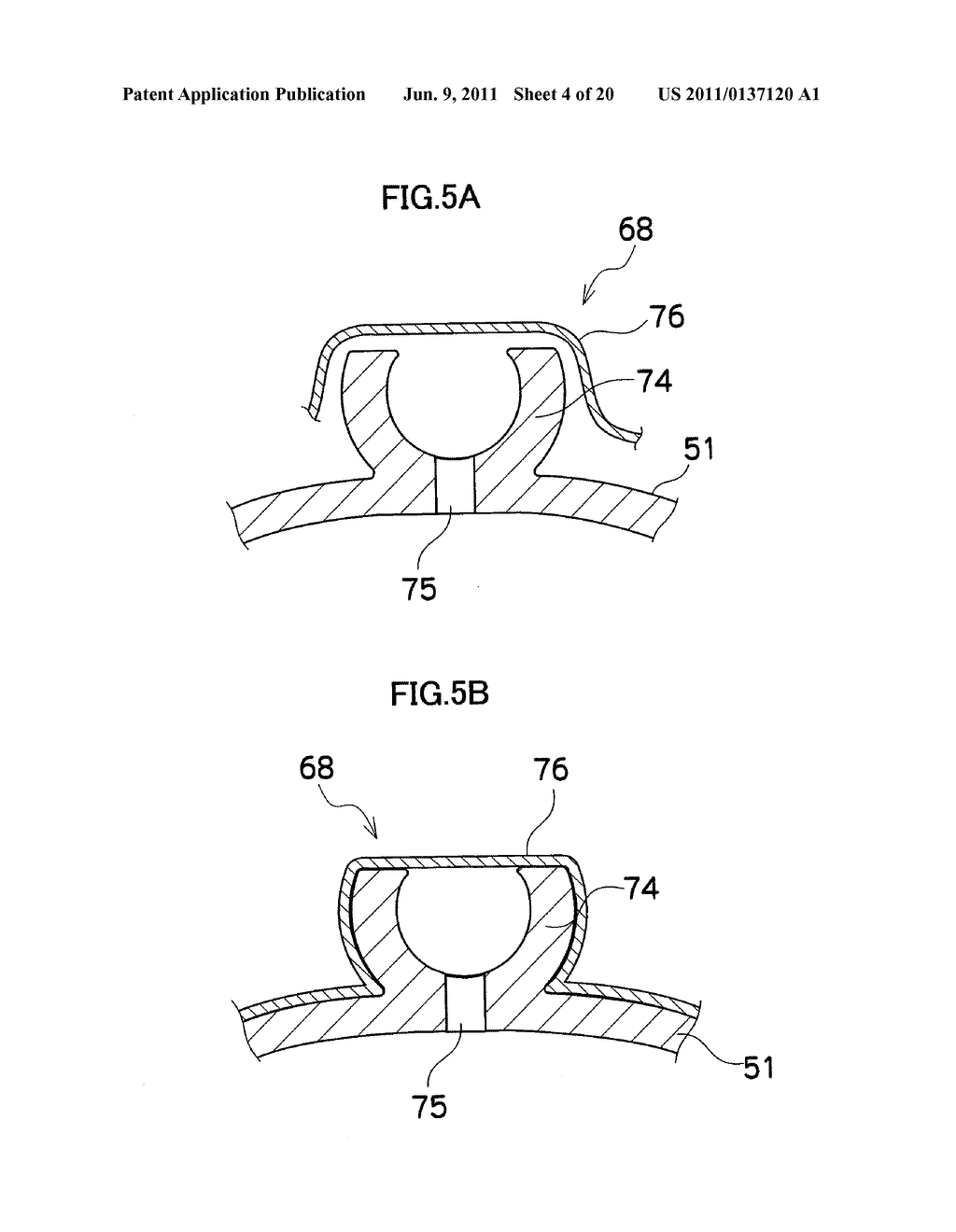 ENDOSCOPE APPARATUS - diagram, schematic, and image 05