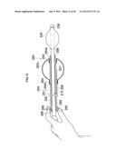 ENDOSCOPE APPARATUS diagram and image