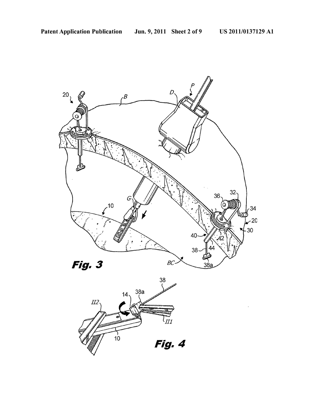 LAPAROSCOPIC SCAFFOLD ASSEMBLY - diagram, schematic, and image 03