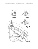 LAPAROSCOPIC SCAFFOLD ASSEMBLY diagram and image