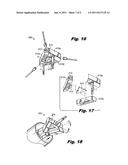 LAPAROSCOPIC SCAFFOLD ASSEMBLY diagram and image