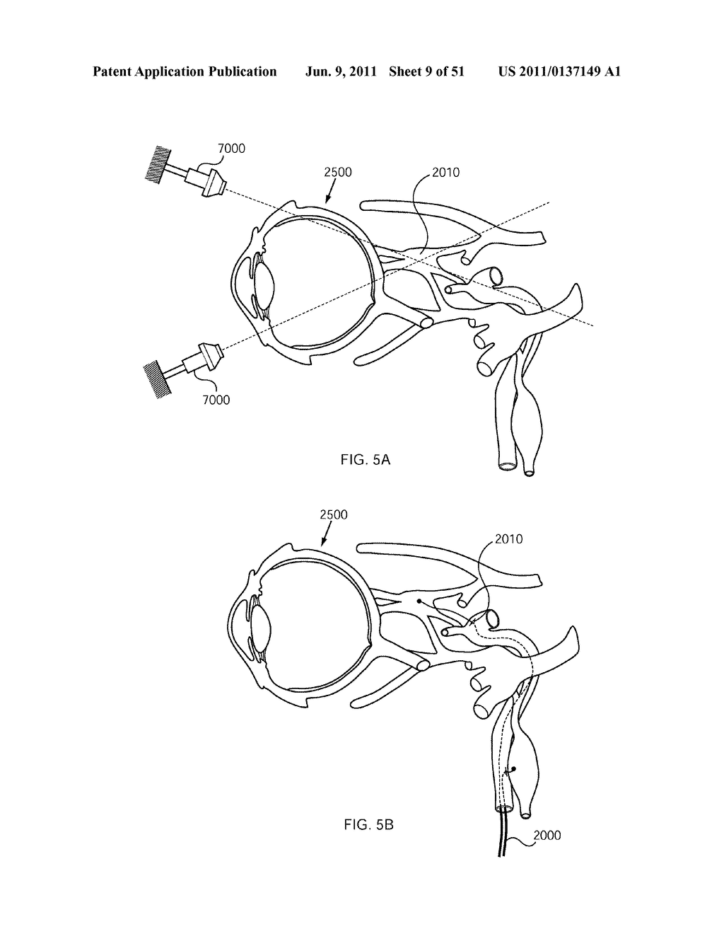 NERVE TREATMENT SYSTEM - diagram, schematic, and image 10