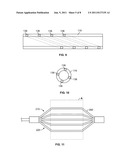 DELIVERY DEVICE FOR LOCALIZED DELIVERY OF A THERAPEUTIC AGENT diagram and image