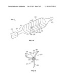 DELIVERY DEVICE FOR LOCALIZED DELIVERY OF A THERAPEUTIC AGENT diagram and image