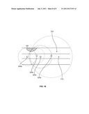 DELIVERY DEVICE FOR LOCALIZED DELIVERY OF A THERAPEUTIC AGENT diagram and image