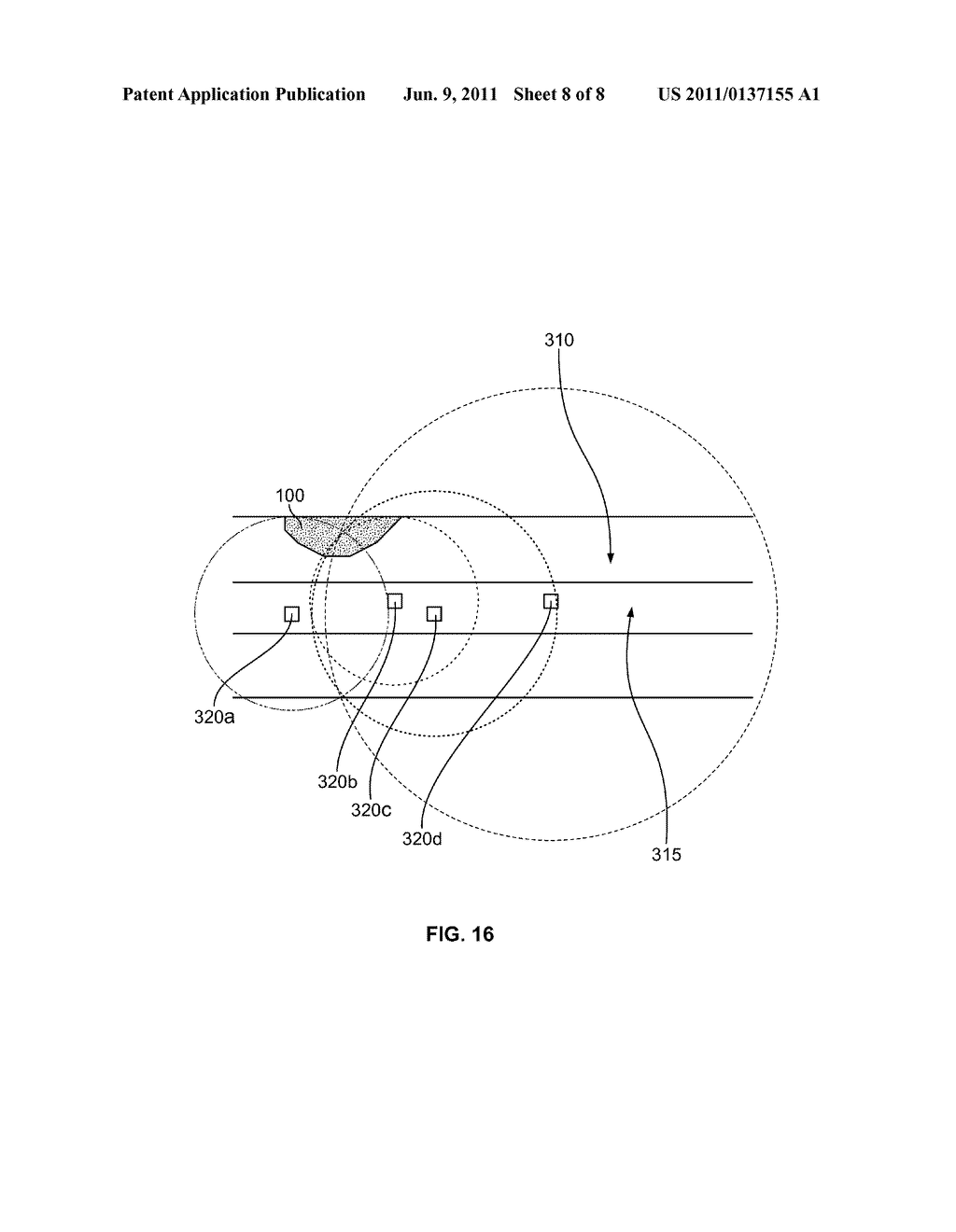 DELIVERY DEVICE FOR LOCALIZED DELIVERY OF A THERAPEUTIC AGENT - diagram, schematic, and image 09