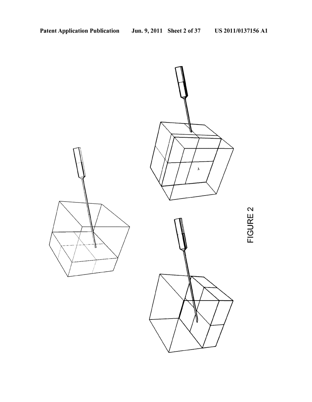 SYSTEMS, METHODS, APPARATUSES, AND COMPUTER-READABLE MEDIA FOR IMAGE     MANAGEMENT IN IMAGE-GUIDED MEDICAL PROCEDURES - diagram, schematic, and image 03