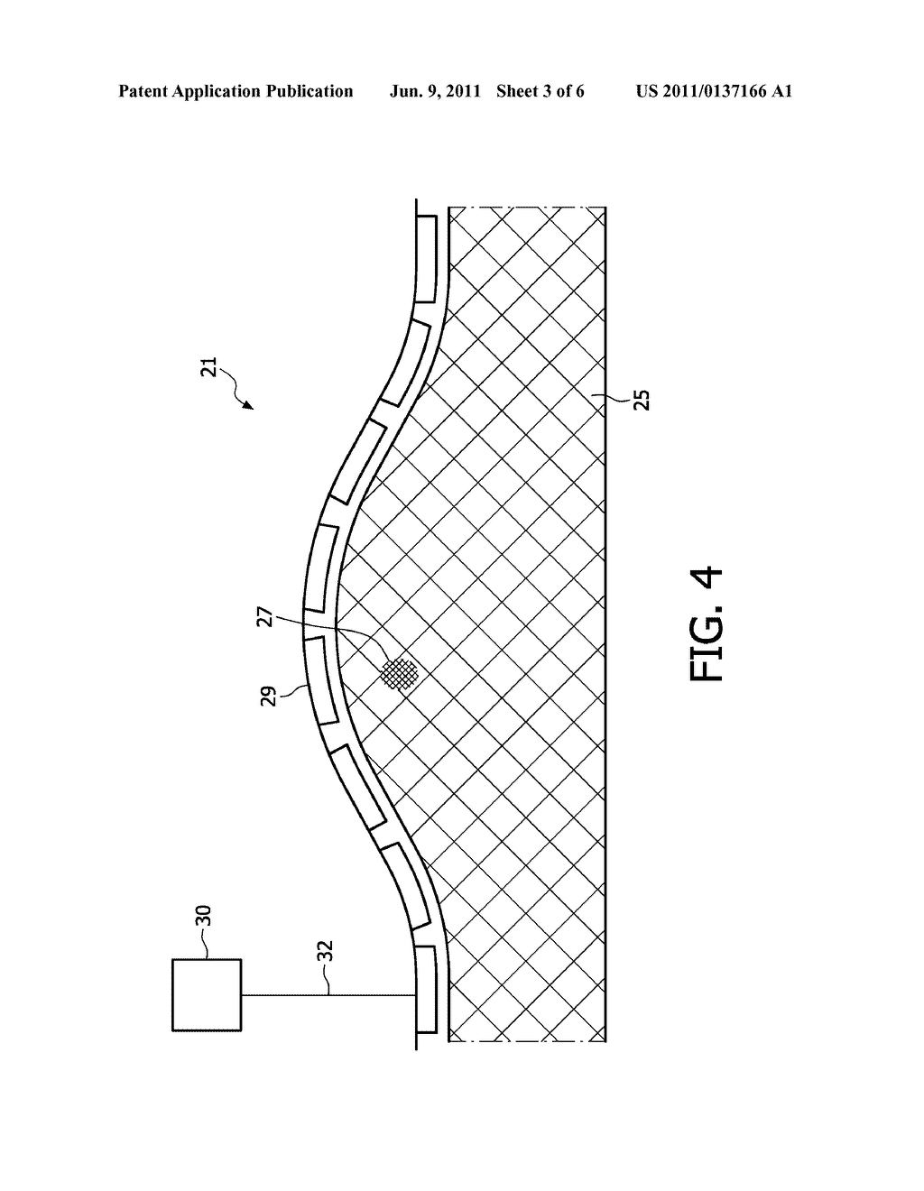 TRANSDUCER ARRANGEMENT AND METHOD FOR ACQUIRING SONO-ELASTOGRAPHICAL DATA     AND ULTRASONIC DATA OF A MATERIAL - diagram, schematic, and image 04