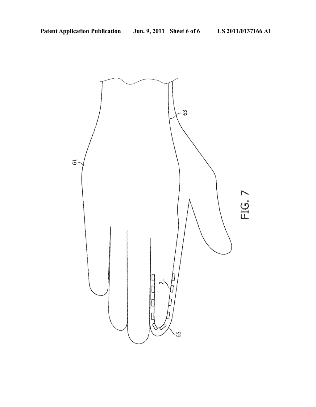 TRANSDUCER ARRANGEMENT AND METHOD FOR ACQUIRING SONO-ELASTOGRAPHICAL DATA     AND ULTRASONIC DATA OF A MATERIAL - diagram, schematic, and image 07