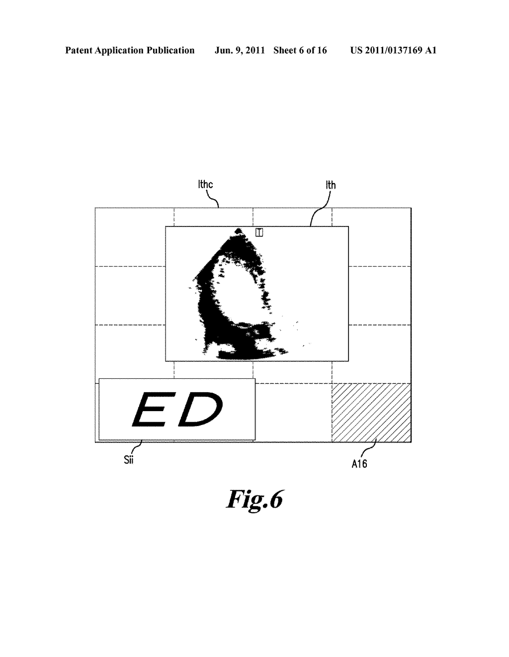 MEDICAL IMAGE PROCESSING APPARATUS, A MEDICAL IMAGE PROCESSING METHOD, AND     ULTRASONIC DIAGNOSIS APPARATUS - diagram, schematic, and image 07