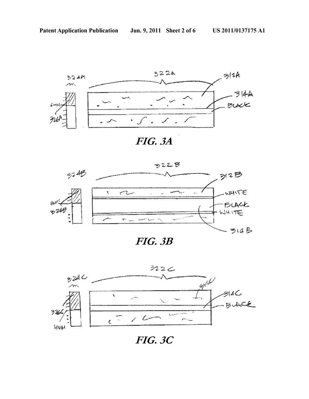 TRACKED ULTRASOUND VESSEL IMAGING - diagram, schematic, and image 03