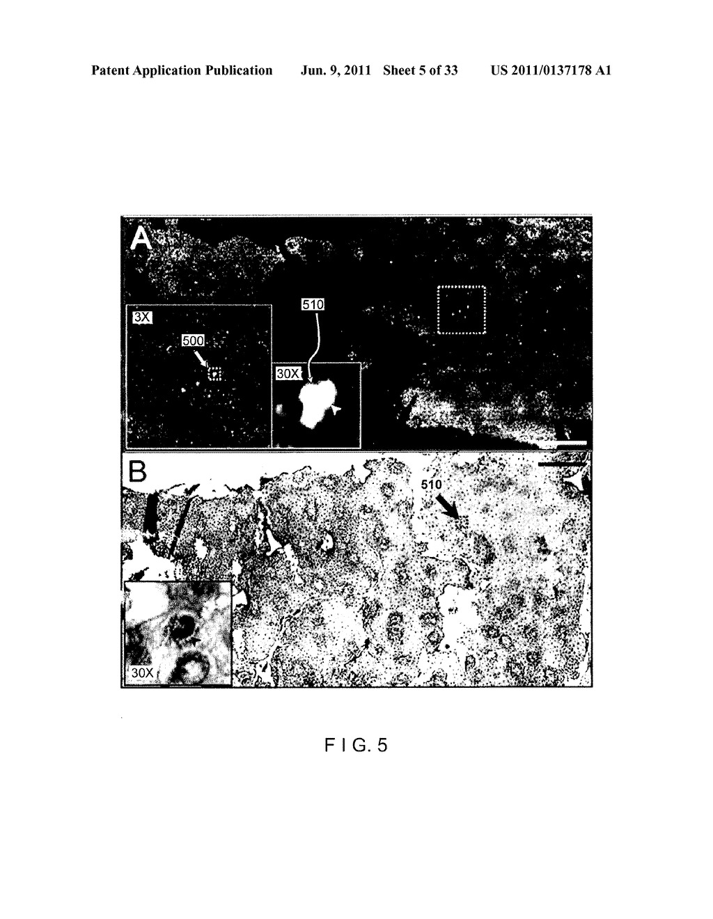 Devices and methods for imaging particular cells including eosinophils - diagram, schematic, and image 06