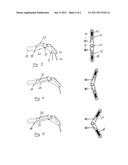 KNEE-JOINT ORTHOSIS diagram and image