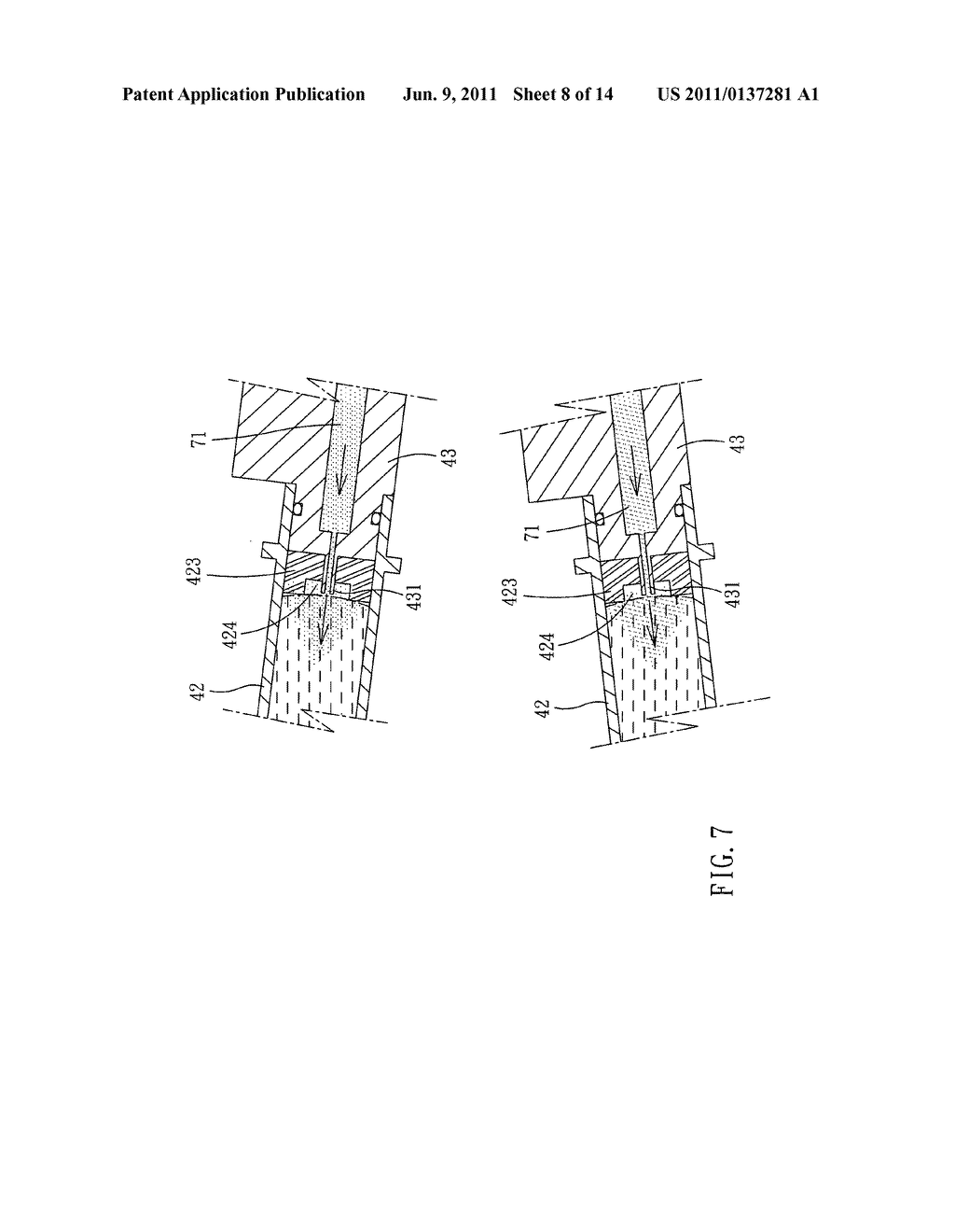 Drug delivery device - diagram, schematic, and image 09