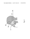 Method and Device for Nasal Irrigation and drug delivery diagram and image