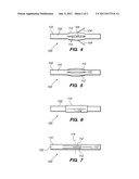 RF ABLATION PROBES WITH TINE VALVES diagram and image