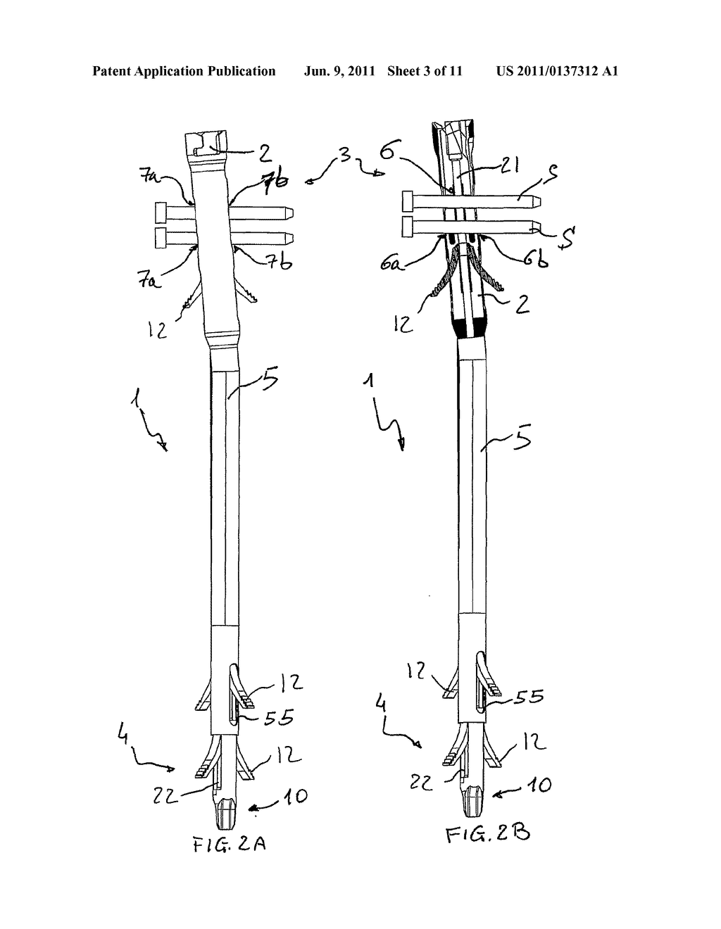 INTERMARROW NAIL TO BE INSERTED INTO A FRACTURED LONG BONE - diagram, schematic, and image 04