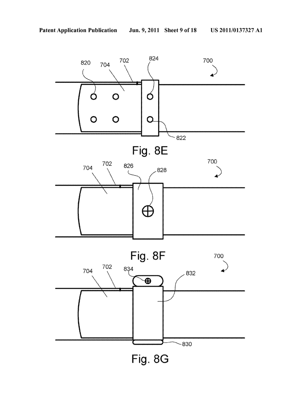 SUBCUTANEOUS WAIST BAND AND METHODS RELATED THERETO - diagram, schematic, and image 10