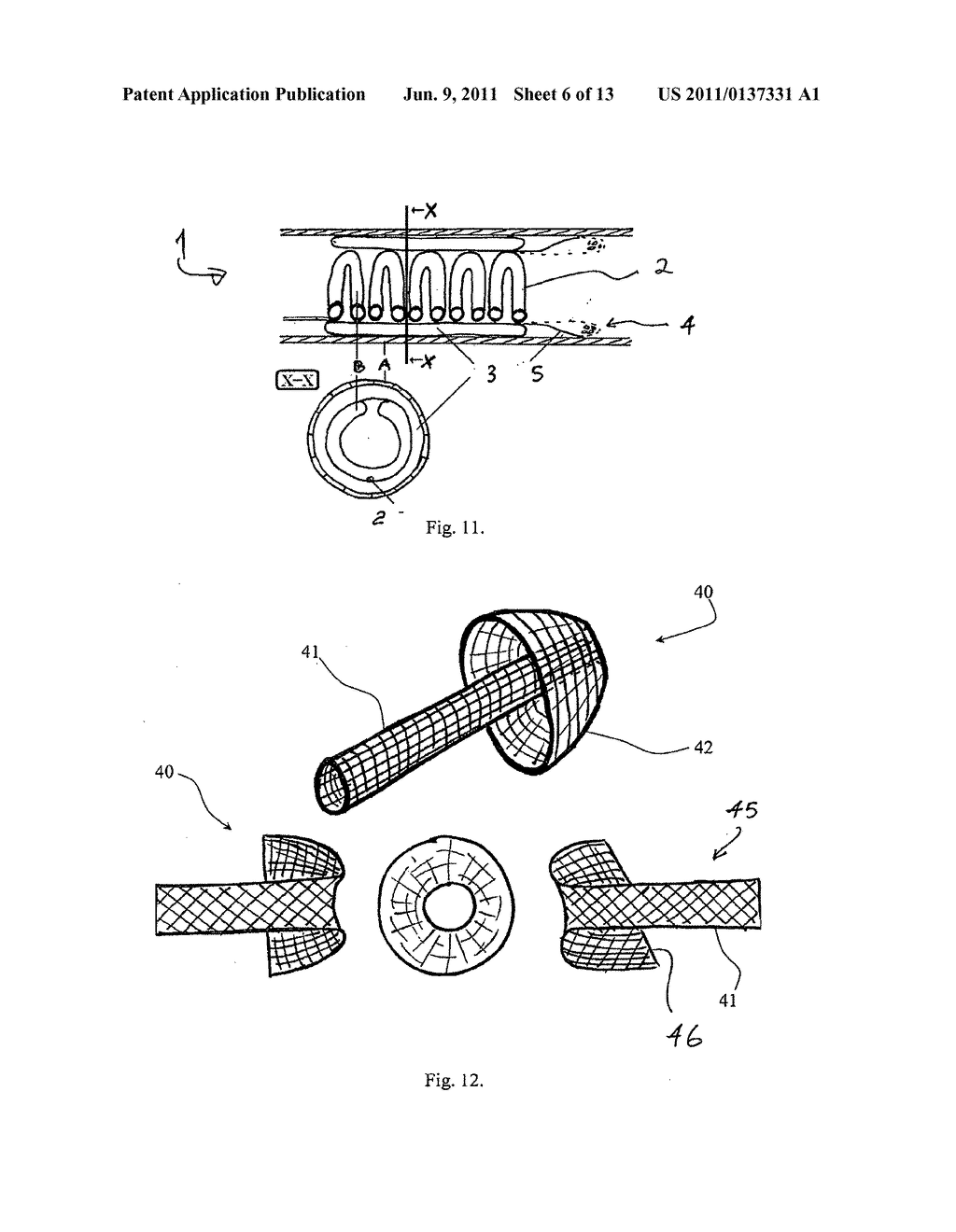 Perfusion device - diagram, schematic, and image 07