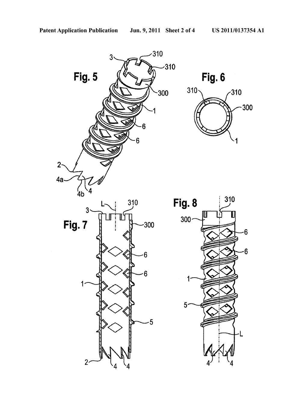 BONE SCREW - diagram, schematic, and image 03