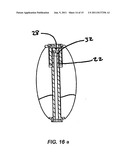 BONE COMPRESSION DEVICE AND METHODS diagram and image