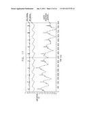 THORACIC AORTA AND VAGUS NERVE STIMULATION diagram and image