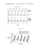 THORACIC AORTA AND VAGUS NERVE STIMULATION diagram and image