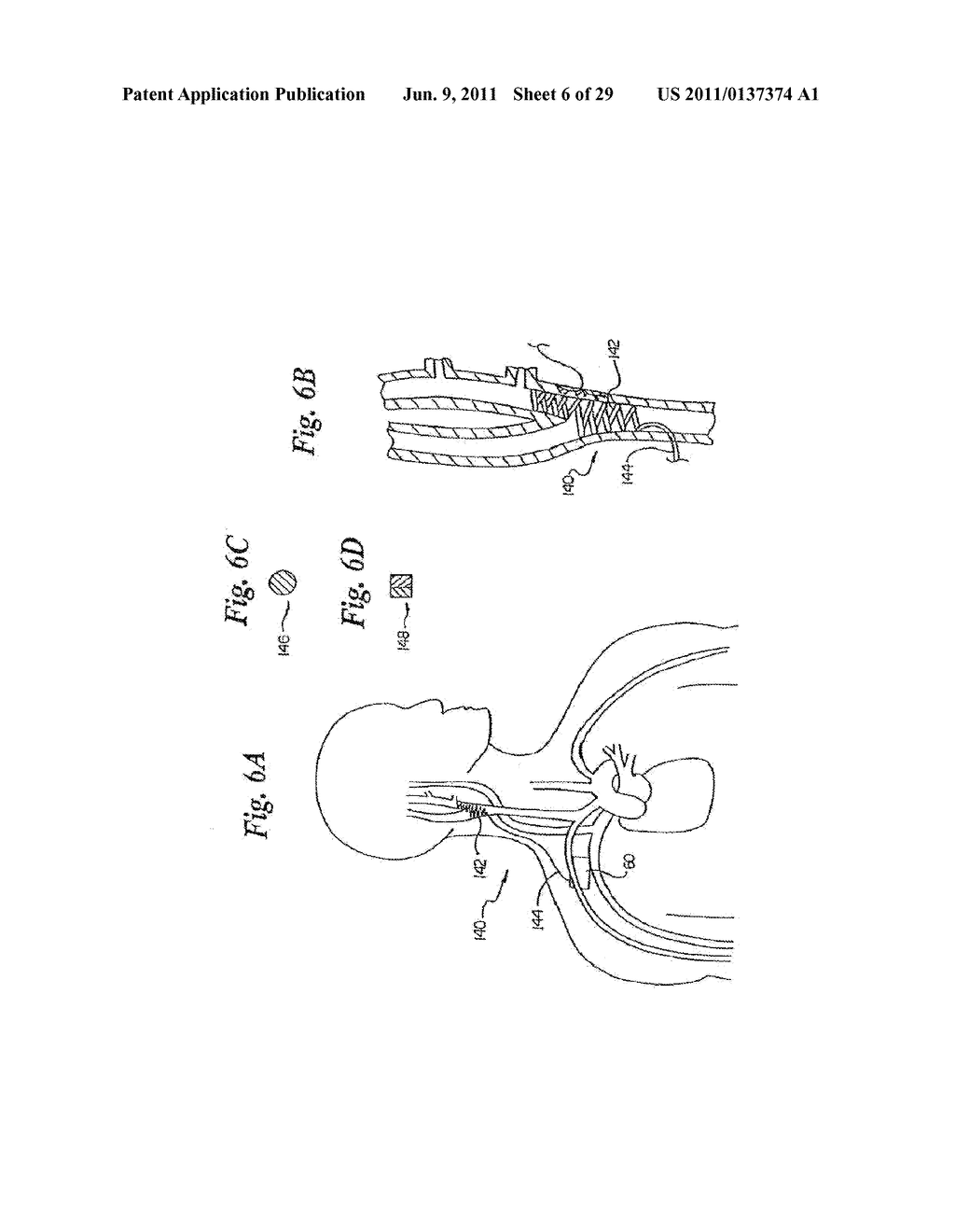 DEVICES AND METHODS FOR ELECTRODE IMPLANTATION - diagram, schematic, and image 07