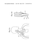 DEVICES AND METHODS FOR ELECTRODE IMPLANTATION diagram and image