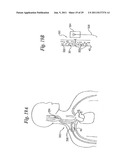 DEVICES AND METHODS FOR ELECTRODE IMPLANTATION diagram and image