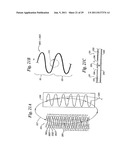 DEVICES AND METHODS FOR ELECTRODE IMPLANTATION diagram and image