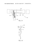 DEVICES AND METHODS FOR ELECTRODE IMPLANTATION diagram and image