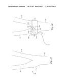 DEVICES AND METHODS FOR ELECTRODE IMPLANTATION diagram and image