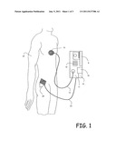 METHOD AND SYSTEM FOR INVASIVE SKIN TREATMENT diagram and image