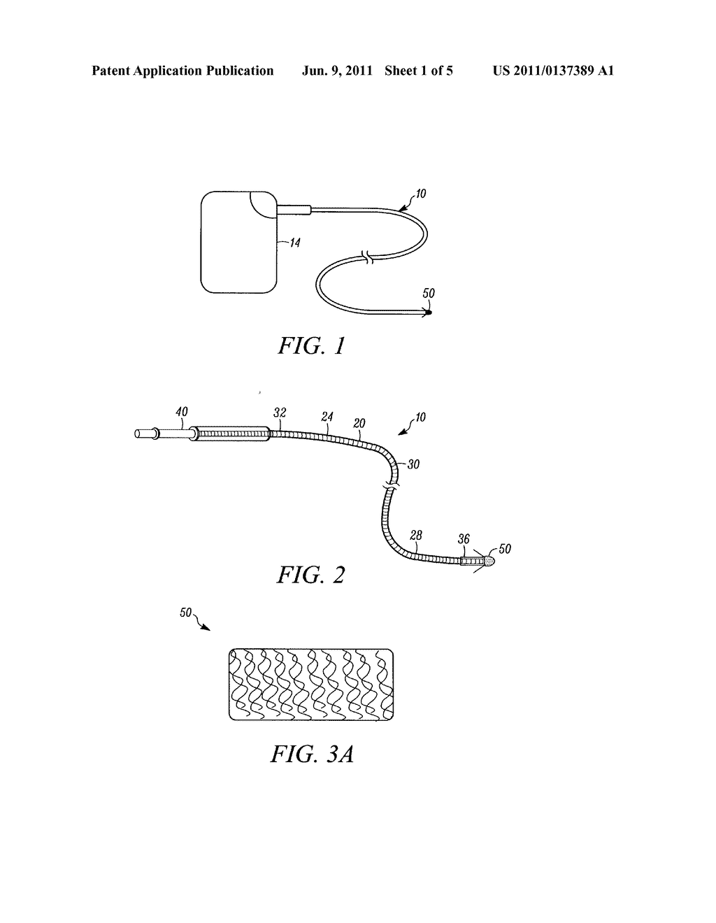 FIBROUS ELECTRODE MATERIAL - diagram, schematic, and image 02