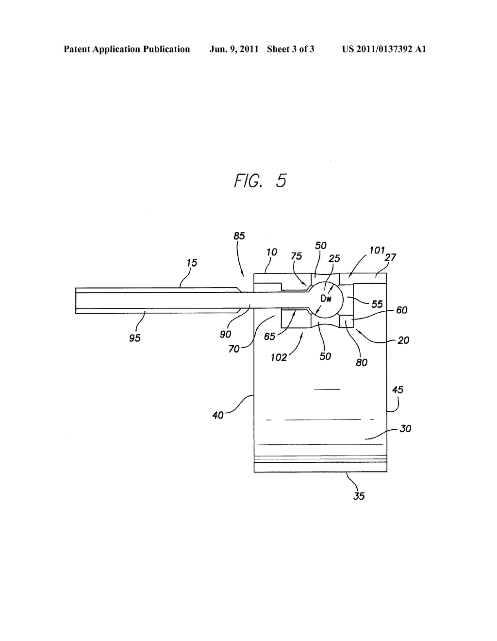 MECHANISM FOR, AND METHOD OF, ATTACHING A LEAD CONDUCTOR CABLE TO A LEAD     ELECTRODE - diagram, schematic, and image 04