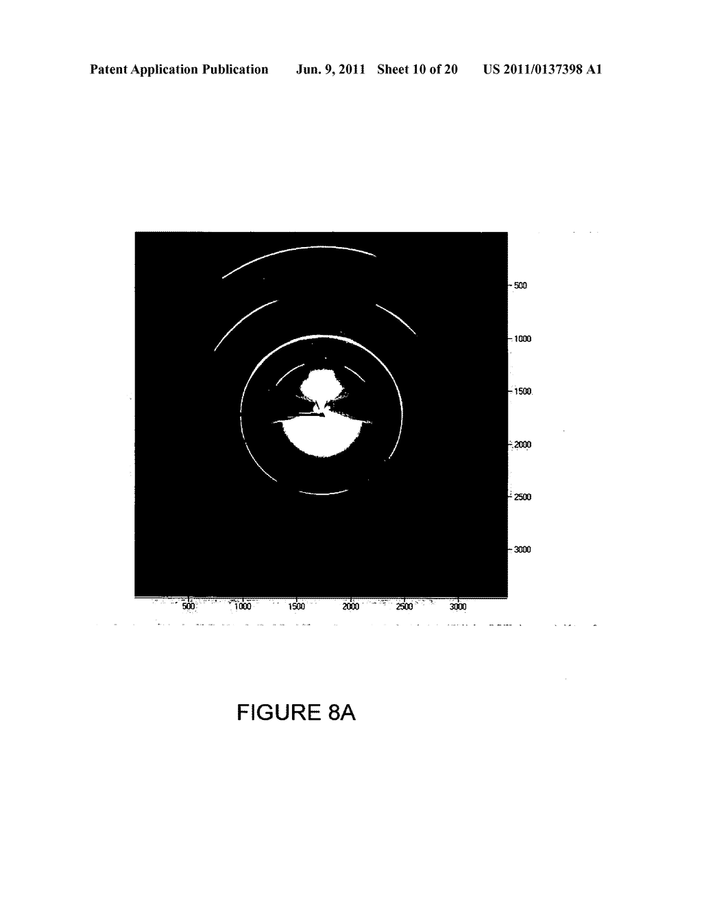 METHOD OF LOADING A MEDICAL DEVICE INTO A DELIVERY SYSTEM - diagram, schematic, and image 11