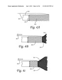 Microvalve Protection Device and Method of Use for Protection Against     Embolization Agent Reflux diagram and image