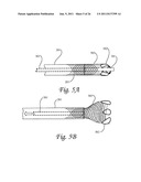 Microvalve Protection Device and Method of Use for Protection Against     Embolization Agent Reflux diagram and image