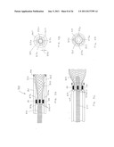 Microvalve Protection Device and Method of Use for Protection Against     Embolization Agent Reflux diagram and image