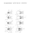 Microvalve Protection Device and Method of Use for Protection Against     Embolization Agent Reflux diagram and image