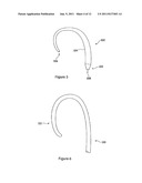 INTRODUCER FOR ENDOVASCULAR IMPLANTS diagram and image